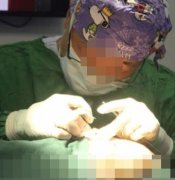 北京八大處醫(yī)院技術(shù)靠譜嗎？隆鼻真人案例自述展示