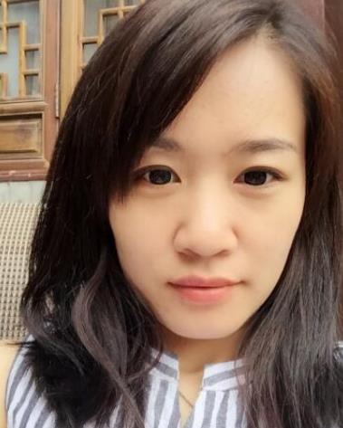 華西醫(yī)院卿勇醫(yī)生隆鼻案例分享，術(shù)后果真實(shí)圖流出