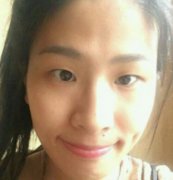 山東省立醫(yī)院薛峰雙眼皮果如何？術(shù)后恢復(fù)打卡！