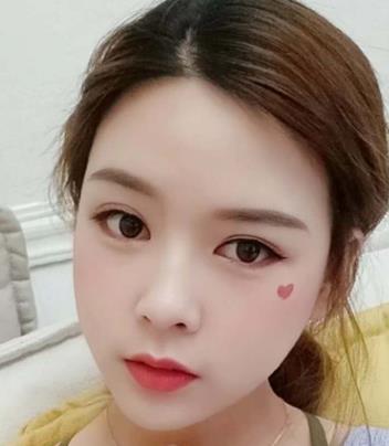 【張笑天】磨骨怎么樣？醫(yī)生介紹及真人案例分享