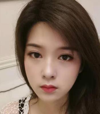 【張笑天】磨骨怎么樣？醫(yī)生介紹及真人案例分享