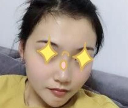 上海伊美爾港華醫(yī)院磨骨真人案例果圖流出：對比挺明X