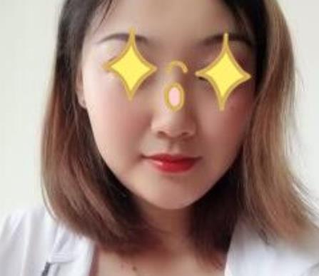 上海伊美爾港華醫(yī)院磨骨真人案例果圖流出：對比挺明X