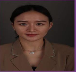 長(zhǎng)春趙廣文院長(zhǎng)眼部手術(shù)術(shù)后半年果分享：眼型較為適合我