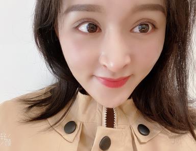 長(zhǎng)春趙廣文院長(zhǎng)眼部手術(shù)術(shù)后半年果分享：眼型較為適合我