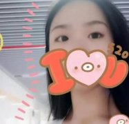 成都華西醫(yī)院雙眼皮做的怎么樣？看真人案例展示醫(yī)生技術(shù)！