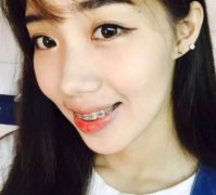 重慶醫(yī)科大學(xué)口腔醫(yī)院整牙咋樣?牙齒矯正真人案例反饋分享