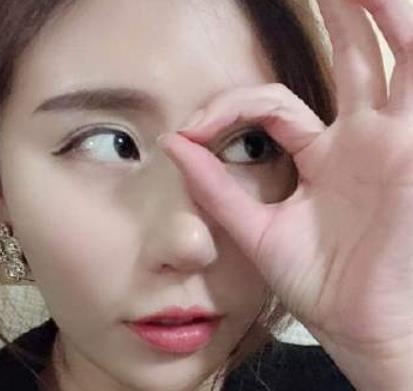 北京藝美王東醫(yī)生脂肪填充案例公開，術(shù)后太陽(yáng)穴飽滿自然