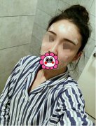 溫州藝星醫(yī)學(xué)美容醫(yī)院自體脂肪填充面部果反饋，飽滿自然少女臉