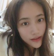 上海九院整形科隆鼻案例術(shù)后恢復(fù)過(guò)程反饋圖分享，自然還沒(méi)有留疤