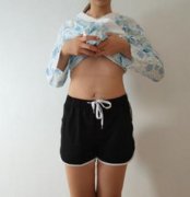 成都玉之光大腿吸脂案例分享，瘦腿就是這么簡單！