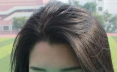 美人尖可以剃掉嗎？合適美人尖的發(fā)型有哪些？