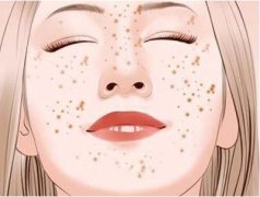 激光調(diào)節(jié)雀斑怎么樣