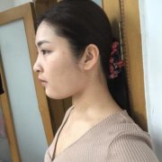 淮安市婦幼保健院整形科隆胸口碑好嗎？真人案例果照片瞧瞧吧！