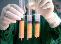 吸脂減肥一般價(jià)格是多少?抽脂多少錢?