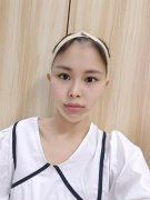 北大口腔醫(yī)院李自力正頜怎么樣？醫(yī)生案例果圖~恢復(fù)心得一覽