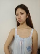 北京圣嘉新磨骨怎么樣？下頜角整形案例和優(yōu)惠價(jià)格查詢