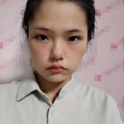 華西醫(yī)院整形美容科技術(shù)怎么樣？對比面部拉皮提升案例恢復(fù)果反饋