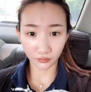 西京醫(yī)院燒傷整形科都做什么項目？附上隆鼻案例和收費價格表