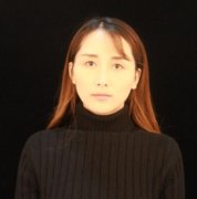 安徽醫(yī)科大學(xué)第一附屬醫(yī)院整形外科價(jià)目表！附隆鼻案例口碑評(píng)價(jià)