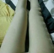 福州美貝爾吸脂怎么樣？參考吸脂案例術(shù)后恢復(fù)情況反饋