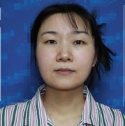 揚州中醫(yī)院割雙眼皮怎么樣？案例前后對比圖~恢復護理過程分享