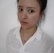 成都西區(qū)醫(yī)院整形科去眼袋果如何？真人案例恢復(fù)記錄查詢