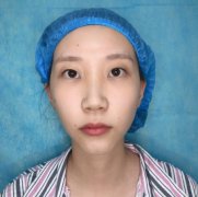 河北省人民醫(yī)院割雙眼皮價(jià)格表2021更新中！還有案例果參考哦！