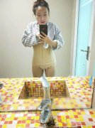 上海長征醫(yī)院整形外科腰腹吸脂案例~含具體價格費用清單哦！