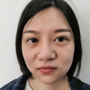 蚌埠一附院整形外科隆鼻案例~價(jià)格表2021收費(fèi)標(biāo)準(zhǔn)反饋