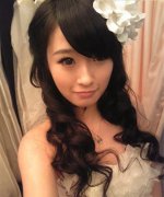 北京市中西醫(yī)結(jié)合醫(yī)院整形美容科面部吸脂案例~分享下術(shù)后果圖