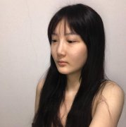 成都棕南醫(yī)院隆鼻怎么樣？案例恢復(fù)果圖實(shí)拍