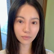 劉志剛院長做眼睛收費(fèi)貴嗎？價格表及雙眼皮案例在線分享