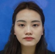 千佛山醫(yī)院安綱雙眼皮手術(shù)怎么？網(wǎng)上提前看術(shù)后果圖對比