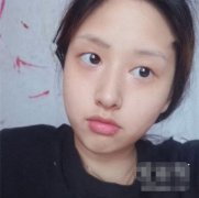 華韓奇致裴炳萬修復(fù)雙眼皮如何？先看看案例恢復(fù)前后對比圖再說~