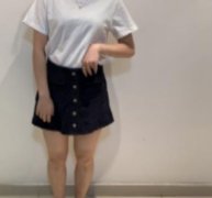 江蘇省中醫(yī)院整形外科吸脂價格怎么樣？2021全新案例果圖公布