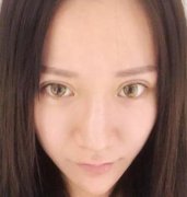 北京八大處趙延勇擅長什么？鼻部手術整形案例公布！含收費詳情