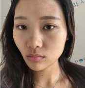 九院做熱瑪吉在哪個(gè)科？真實(shí)案例和價(jià)格收費(fèi)來(lái)嘍~