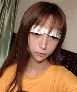 北京嘉禾醫(yī)學美容正規(guī)嗎?割雙眼皮案例和價格表全新參考