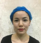 南京第一人民醫(yī)院整形科做的鼻子怎么樣？案例圖價(jià)格表奉上對(duì)比