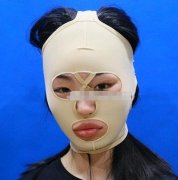 西安西京醫(yī)院整形科顴骨內(nèi)推怎么樣？專家案例果反饋！價格表清單一覽！