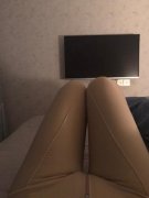 溫州醫(yī)科大學(xué)附屬第二醫(yī)院整形科吸脂怎么樣？價(jià)格及案例前后變化圖公開