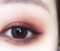 割雙眼皮一般要多少錢?什么時(shí)候割雙眼皮合適?