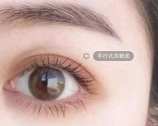 割雙眼皮需要注意什么?割雙眼皮有風(fēng)險(xiǎn)嗎?