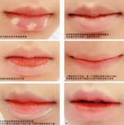 有哪些唇部整形手術(shù)?果一般能持續(xù)多久?