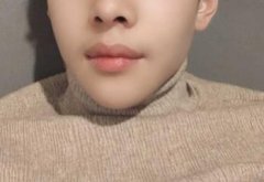 什么是厚嘴唇變薄術(shù)?厚嘴唇變薄術(shù)后多久能恢復(fù)?