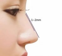 肋鼻部手術(shù)多少錢(qián)?鼻骨整形手術(shù)果怎么樣?