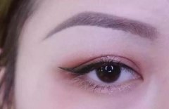 抬眼眉手術(shù)多少錢?眼部抬眉手術(shù)疼嗎?