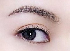 抬眉手術(shù)需要多長(zhǎng)時(shí)間恢復(fù)?抬眉手術(shù)可以持續(xù)幾年?