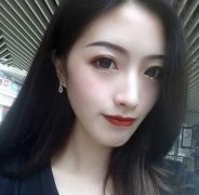 重醫(yī)附二院整形科怎么樣？快來參考埋線雙眼皮案例及價(jià)格價(jià)目表